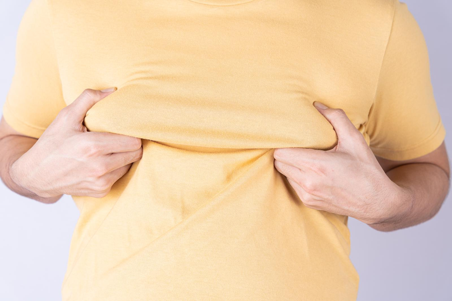 A man with gynecomastia from steroid use, wearing a yellow shirt and squeezing his man boobs